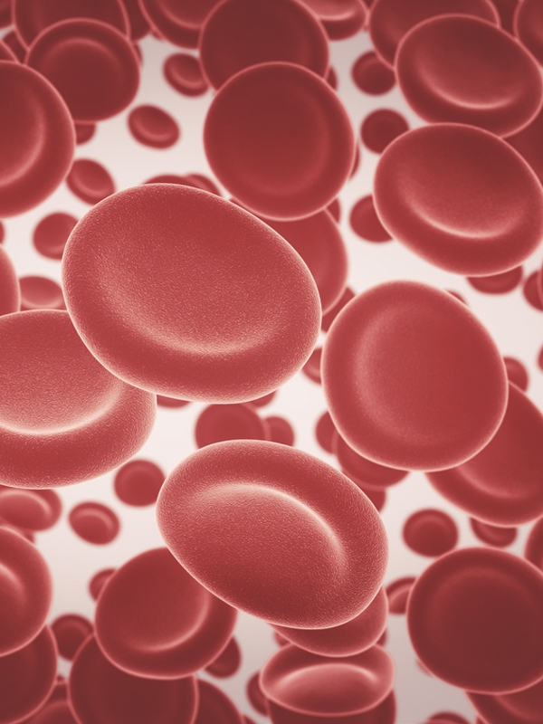 Anemia - Iron-Deficiency (Pediatric)